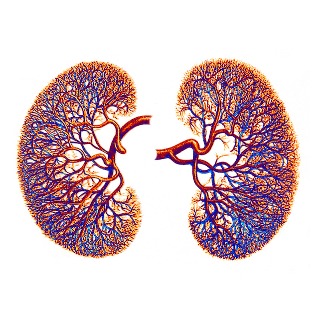 Acute Kidney Injury&nbsp;(AKI)