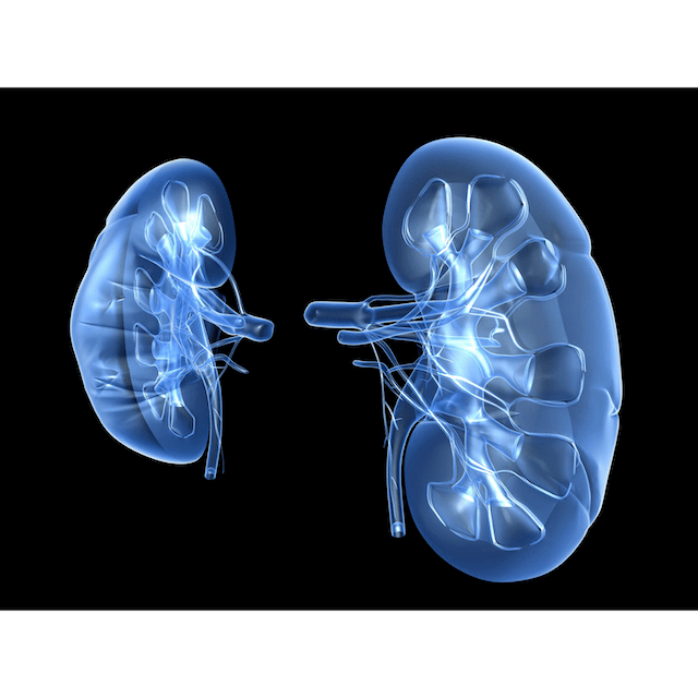 Nephrotic Syndrome