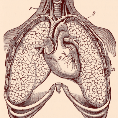 Pulmonary Embolism