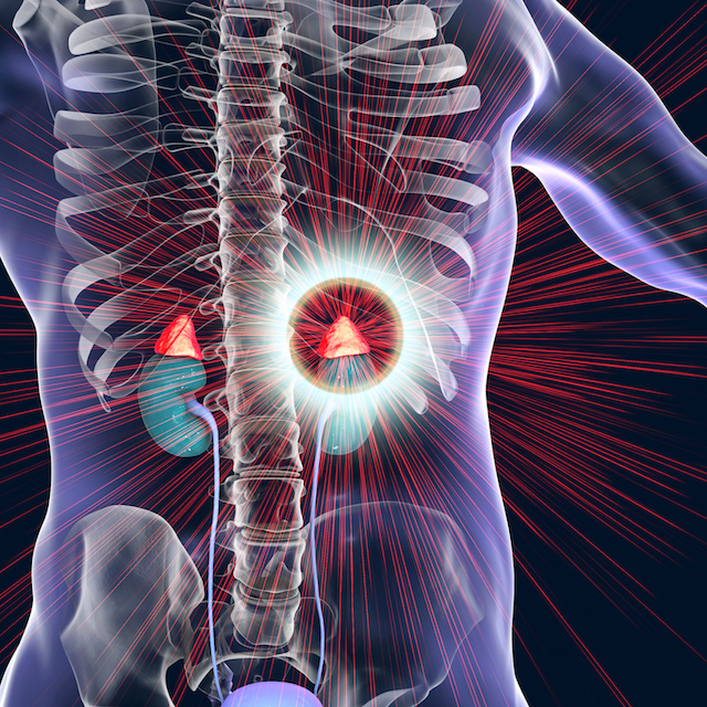 Adrenal Insufficiency