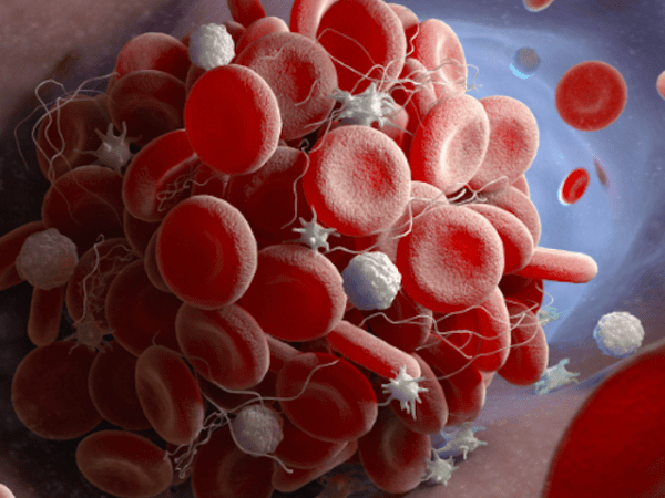 Anticoagulation Reversal