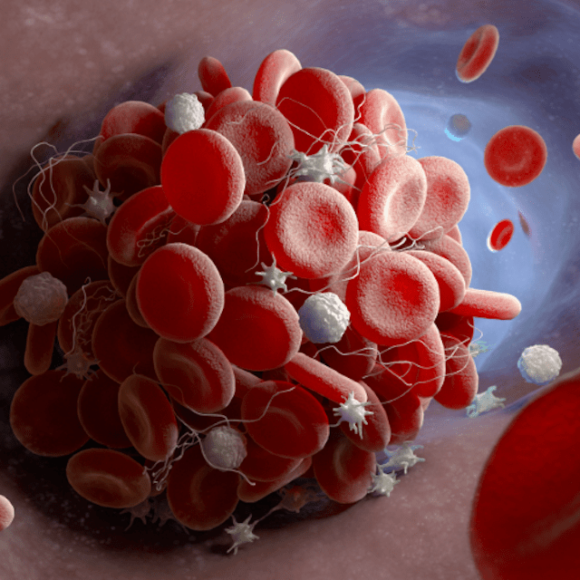 Anticoagulation Reversal